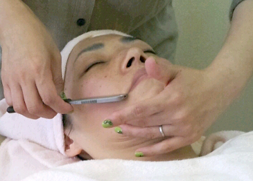 シェービングドレナージュ